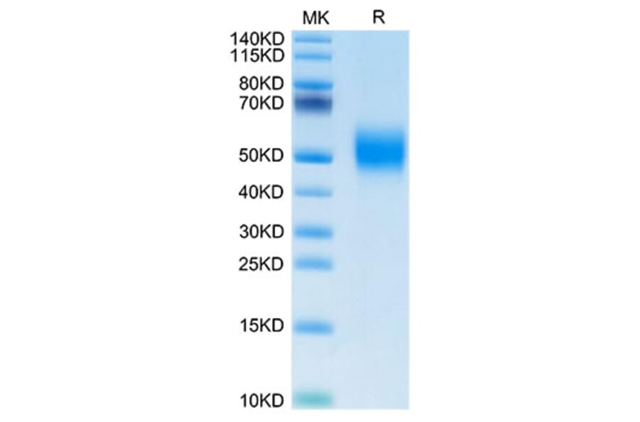 Tris-Bis PAGE - Recombinant Human FGFR2 Protein (Biotin) (C-terminal His and Avi Tag) (A330639) - Antibodies.com