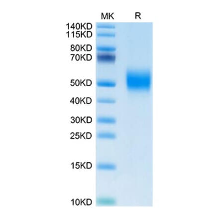 Tris-Bis PAGE - Recombinant Human FGFR2 Protein (Biotin) (C-terminal His and Avi Tag) (A330639) - Antibodies.com