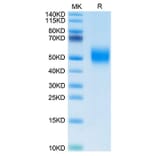 Tris-Bis PAGE - Recombinant Human FGFR2 Protein (Biotin) (C-terminal His and Avi Tag) (A330639) - Antibodies.com