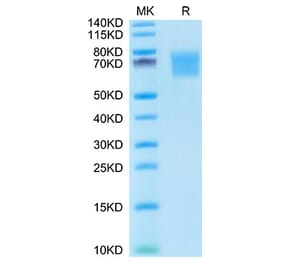 Tris-Bis PAGE - Recombinant Human FGFR2 Protein (C-terminal His Tag) (A330640) - Antibodies.com