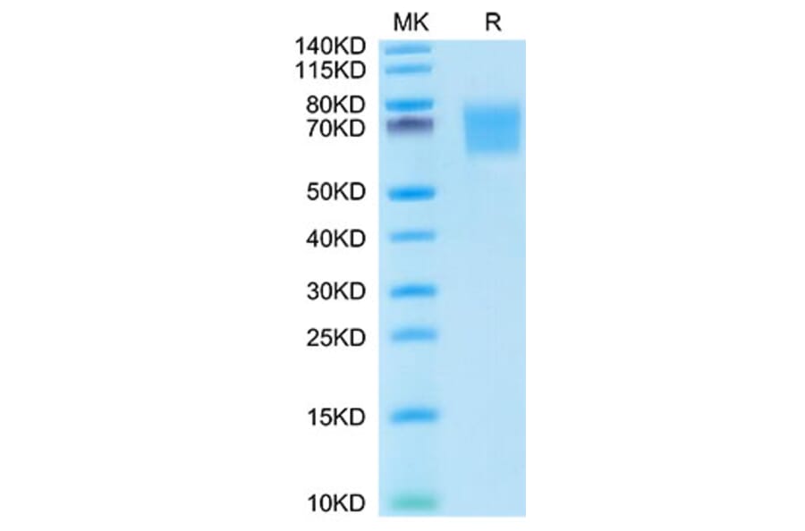 Tris-Bis PAGE - Recombinant Human FGFR2 Protein (C-terminal His Tag) (A330640) - Antibodies.com