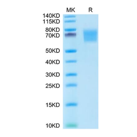 Tris-Bis PAGE - Recombinant Human FGFR2 Protein (C-terminal His Tag) (A330640) - Antibodies.com
