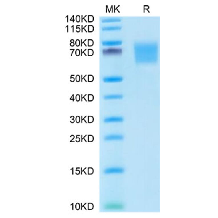 Tris-Bis PAGE - Recombinant Human FGFR2 Protein (C-terminal His Tag) (A330640) - Antibodies.com