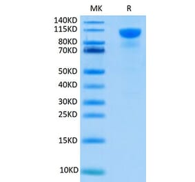 Tris-Bis PAGE - Recombinant Human FGFR2 Protein (C-terminal Human Fc Tag) (A330641) - Antibodies.com