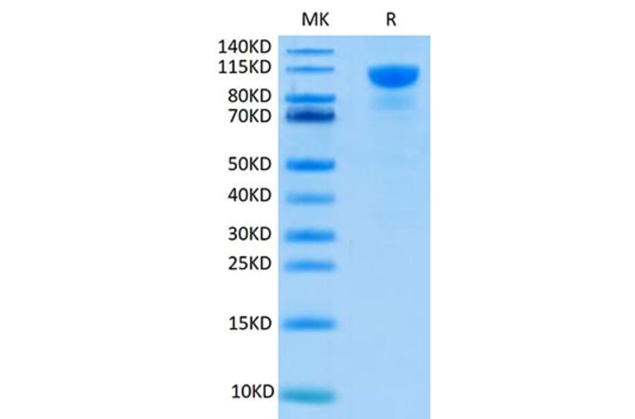 Tris-Bis PAGE - Recombinant Human FGFR2 Protein (C-terminal Human Fc Tag) (A330641) - Antibodies.com