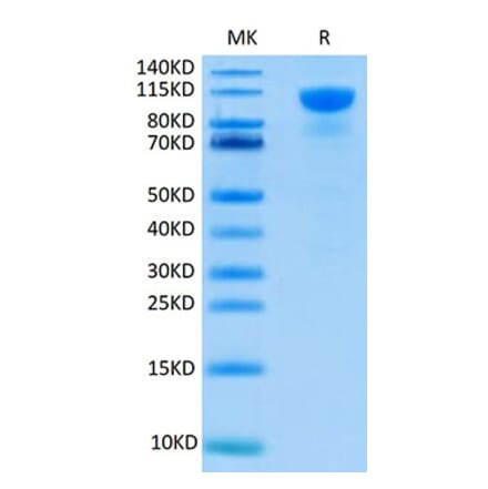 Tris-Bis PAGE - Recombinant Human FGFR2 Protein (C-terminal Human Fc Tag) (A330641) - Antibodies.com