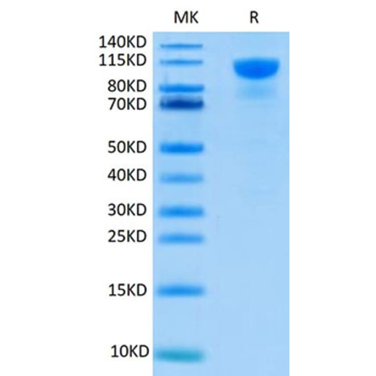 Tris-Bis PAGE - Recombinant Human FGFR2 Protein (C-terminal Human Fc Tag) (A330641) - Antibodies.com