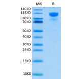 Tris-Bis PAGE - Recombinant Human FGFR2 Protein (C-terminal Human Fc Tag) (A330641) - Antibodies.com
