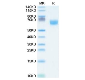Tris-Bis PAGE - Recombinant Human FGFR2 Protein (C-terminal Human Fc Tag) (A330642) - Antibodies.com