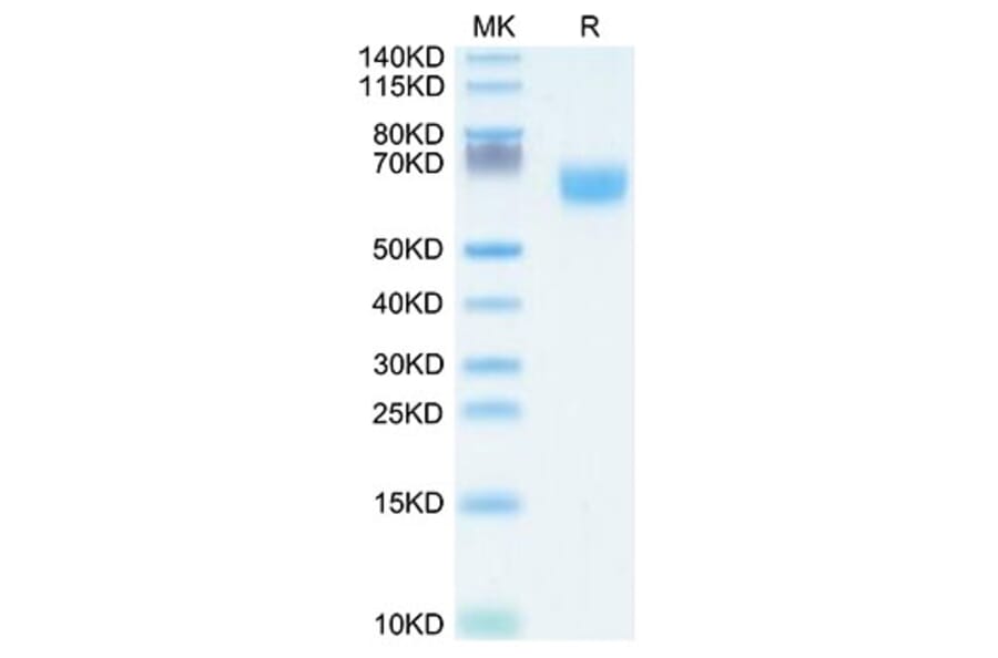 Tris-Bis PAGE - Recombinant Human FGFR2 Protein (C-terminal Human Fc Tag) (A330642) - Antibodies.com