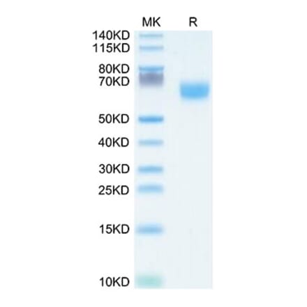 Tris-Bis PAGE - Recombinant Human FGFR2 Protein (C-terminal Human Fc Tag) (A330642) - Antibodies.com