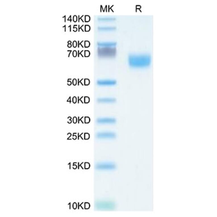 Tris-Bis PAGE - Recombinant Human FGFR2 Protein (C-terminal Human Fc Tag) (A330642) - Antibodies.com