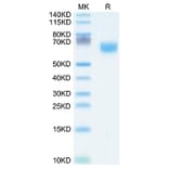 Tris-Bis PAGE - Recombinant Human FGFR2 Protein (C-terminal Human Fc Tag) (A330642) - Antibodies.com