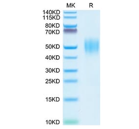 Tris-Bis PAGE - Recombinant Human FGFR2 Protein (C-terminal His Tag) (A330643) - Antibodies.com