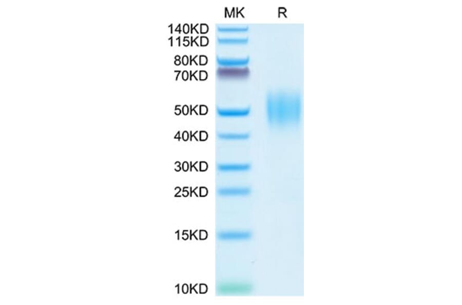 Tris-Bis PAGE - Recombinant Human FGFR2 Protein (C-terminal His Tag) (A330643) - Antibodies.com