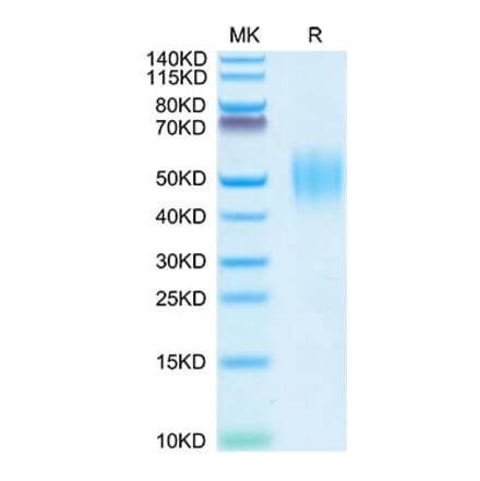 Tris-Bis PAGE - Recombinant Human FGFR2 Protein (C-terminal His Tag) (A330643) - Antibodies.com