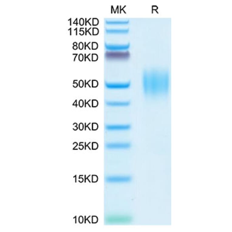 Tris-Bis PAGE - Recombinant Human FGFR2 Protein (C-terminal His Tag) (A330643) - Antibodies.com