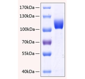SDS-PAGE - Recombinant Human FGFR3 Protein (C-terminal Human Fc and His Tag) (A330644) - Antibodies.com