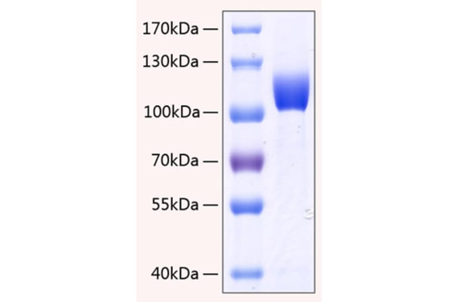 SDS-PAGE - Recombinant Human FGFR3 Protein (C-terminal Human Fc and His Tag) (A330644) - Antibodies.com