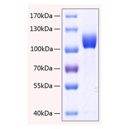 SDS-PAGE - Recombinant Human FGFR3 Protein (C-terminal Human Fc and His Tag) (A330644) - Antibodies.com