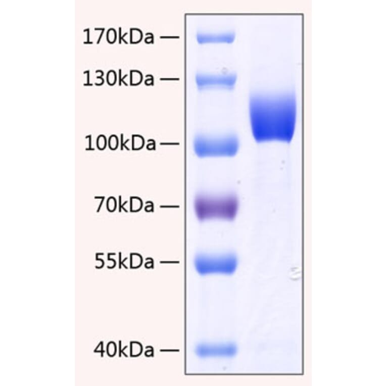 SDS-PAGE - Recombinant Human FGFR3 Protein (C-terminal Human Fc and His Tag) (A330644) - Antibodies.com