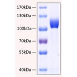 SDS-PAGE - Recombinant Human FGFR3 Protein (C-terminal Human Fc and His Tag) (A330644) - Antibodies.com