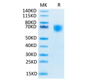 Tris-Bis PAGE - Recombinant Human FGFR3 Protein (Biotin) (C-terminal His and Avi Tag) (A330645) - Antibodies.com