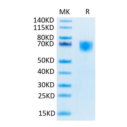 Tris-Bis PAGE - Recombinant Human FGFR3 Protein (Biotin) (C-terminal His and Avi Tag) (A330645) - Antibodies.com