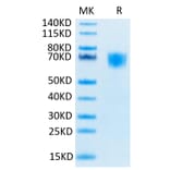 Tris-Bis PAGE - Recombinant Human FGFR3 Protein (Biotin) (C-terminal His and Avi Tag) (A330645) - Antibodies.com