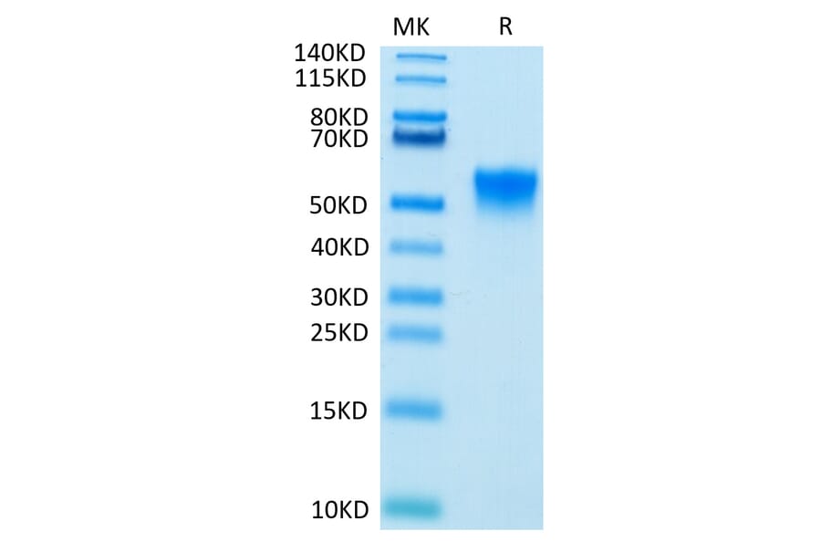 Tris-Bis PAGE - Recombinant Human FGFR3 Protein (Biotin) (C-terminal His and Avi Tag) (A330646) - Antibodies.com