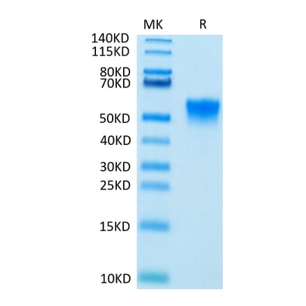 Tris-Bis PAGE - Recombinant Human FGFR3 Protein (Biotin) (C-terminal His and Avi Tag) (A330646) - Antibodies.com