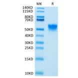 Tris-Bis PAGE - Recombinant Human FGFR3 Protein (Biotin) (C-terminal His and Avi Tag) (A330646) - Antibodies.com
