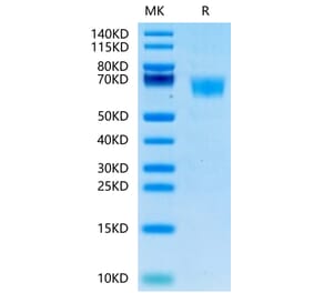 Tris-Bis PAGE - Recombinant Human FGFR3 Protein (C-terminal His and Avi Tag) (A330647) - Antibodies.com