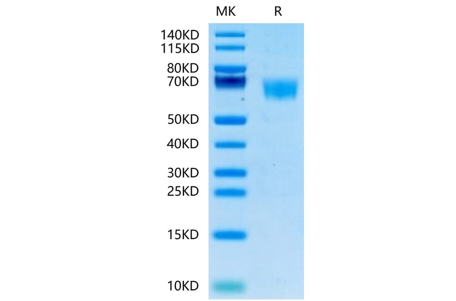 Tris-Bis PAGE - Recombinant Human FGFR3 Protein (C-terminal His and Avi Tag) (A330647) - Antibodies.com