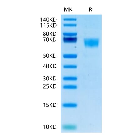 Tris-Bis PAGE - Recombinant Human FGFR3 Protein (C-terminal His and Avi Tag) (A330647) - Antibodies.com