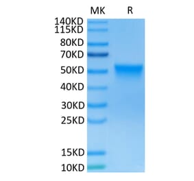 Tris-Bis PAGE - Recombinant Human FGFR3 Protein (C-terminal His and Avi Tag) (A330648) - Antibodies.com