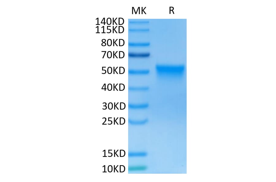 Tris-Bis PAGE - Recombinant Human FGFR3 Protein (C-terminal His and Avi Tag) (A330648) - Antibodies.com