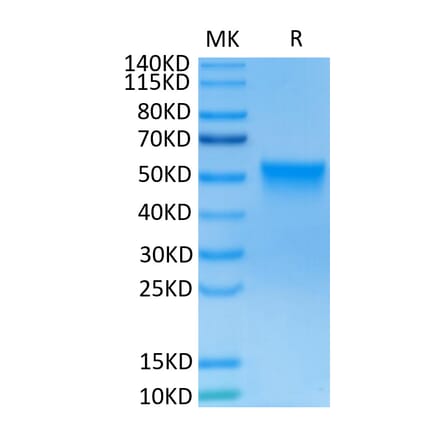 Tris-Bis PAGE - Recombinant Human FGFR3 Protein (C-terminal His and Avi Tag) (A330648) - Antibodies.com