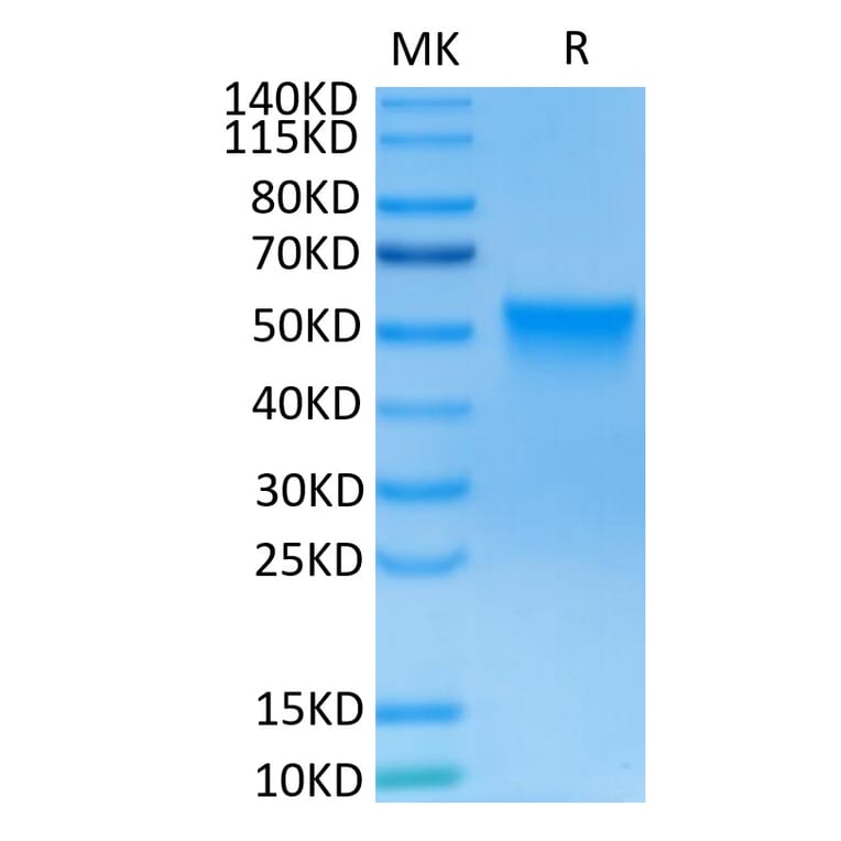 Tris-Bis PAGE - Recombinant Human FGFR3 Protein (C-terminal His and Avi Tag) (A330648) - Antibodies.com