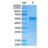 Tris-Bis PAGE - Recombinant Human FGFR3 Protein (C-terminal His and Avi Tag) (A330648) - Antibodies.com