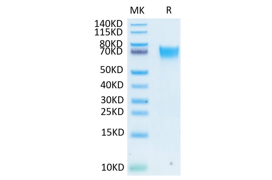 Tris-Bis PAGE - Recombinant Human FGFR3 Protein (Biotin) (C-terminal His and Avi Tag) (A330649) - Antibodies.com