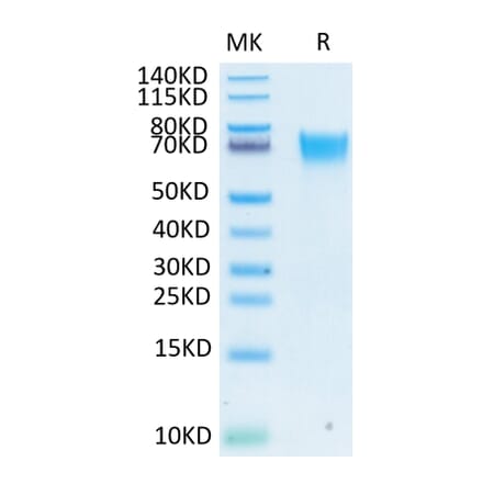 Tris-Bis PAGE - Recombinant Human FGFR3 Protein (Biotin) (C-terminal His and Avi Tag) (A330649) - Antibodies.com