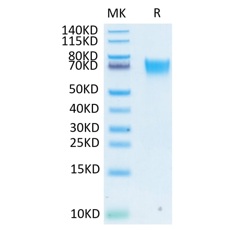 Tris-Bis PAGE - Recombinant Human FGFR3 Protein (Biotin) (C-terminal His and Avi Tag) (A330649) - Antibodies.com