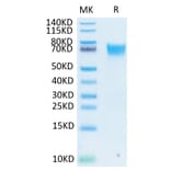 Tris-Bis PAGE - Recombinant Human FGFR3 Protein (Biotin) (C-terminal His and Avi Tag) (A330649) - Antibodies.com