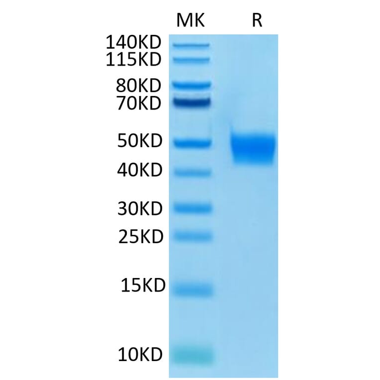 Tris-Bis PAGE - Recombinant Human FGFR3 Protein (Biotin) (C-terminal His and Avi Tag) (A330650) - Antibodies.com
