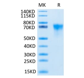 Tris-Bis PAGE - Recombinant Human FGFR3 Protein (C-terminal His and Avi Tag) (A330651) - Antibodies.com