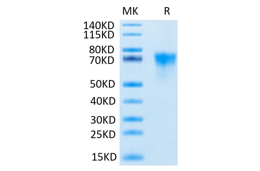Tris-Bis PAGE - Recombinant Human FGFR3 Protein (C-terminal His and Avi Tag) (A330651) - Antibodies.com