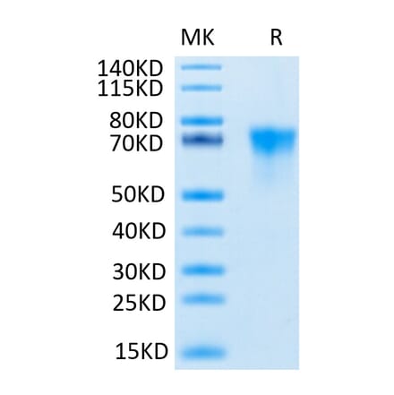 Tris-Bis PAGE - Recombinant Human FGFR3 Protein (C-terminal His and Avi Tag) (A330651) - Antibodies.com