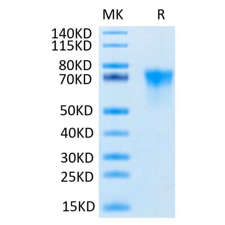 Tris-Bis PAGE - Recombinant Human FGFR3 Protein (C-terminal His and Avi Tag) (A330651) - Antibodies.com