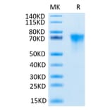 Tris-Bis PAGE - Recombinant Human FGFR3 Protein (C-terminal His and Avi Tag) (A330651) - Antibodies.com